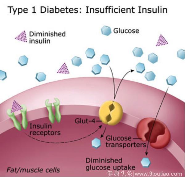 I型糖尿病和II型糖尿病怎么区分？