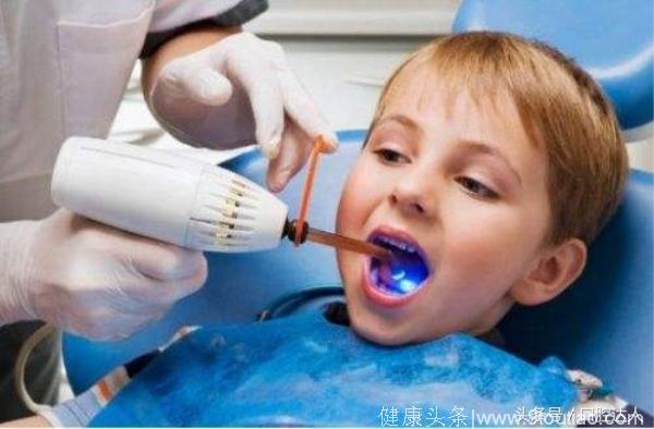 儿童防龋除了好好刷牙，还有窝沟封闭