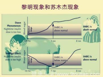 糖尿病患者的两种不同反应，苏木杰现象和黎明现象