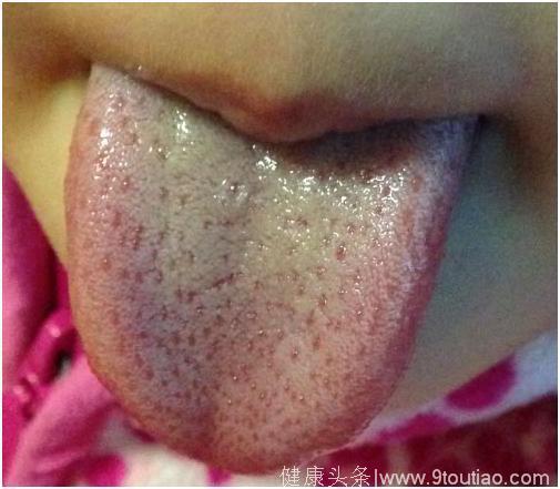 正常小孩的舌头图片图片