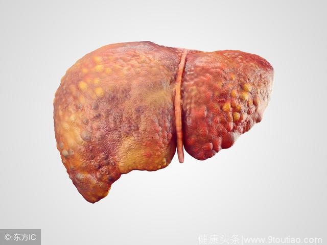 脂肪肝不重视，肝癌早晚来，1个食疗方降转氨酶，“吃掉”脂肪