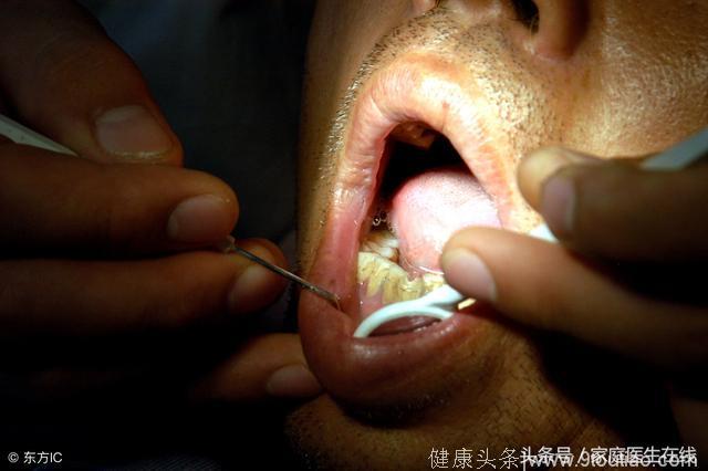口腔疾病会诱发这4种疾病，千万别觉得病小，而不医！