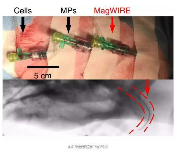脑洞真大！斯坦福科学家发明磁“钓”癌细胞工具