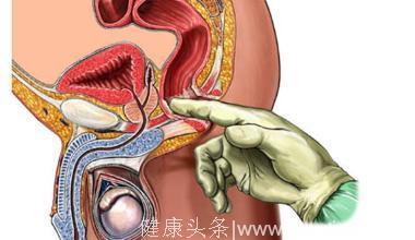 前列腺的按摩疗法 按摩前列腺有哪些作用