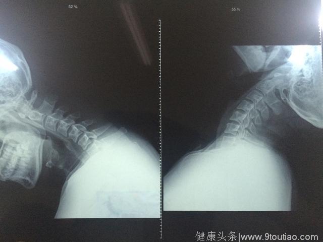 七年前头晕，失眠、心慌、恶心、小手指麻痛不欲生