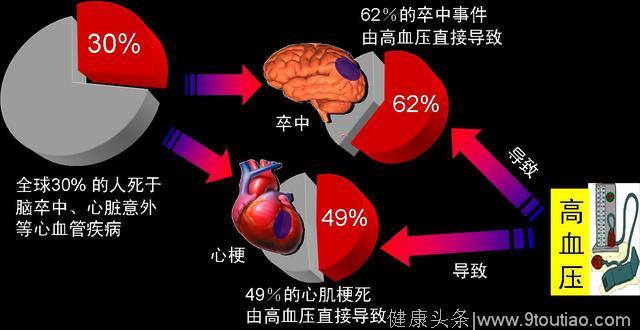 父母有高血压的，子女的遗传概率有多少？