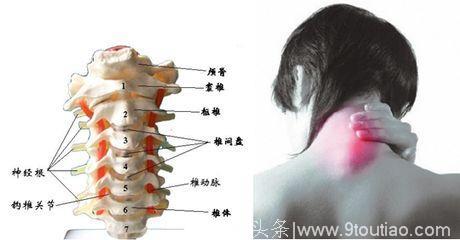 老中医告诉您颈椎病的生活事项，有三大项值得一学！从此不再疼痛