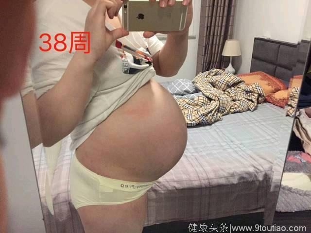 40+6 剖腹产男宝，分享孕期男孩症状，胎梦很准