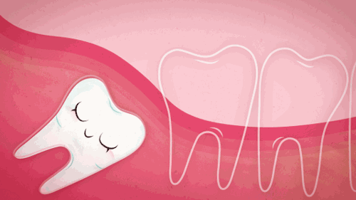 「健康」有一种尴尬叫吃饭塞牙！口腔专家：多半是这5种牙病在作祟