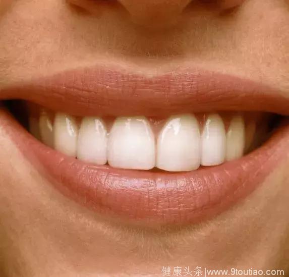 「健康」有一种尴尬叫吃饭塞牙！口腔专家：多半是这5种牙病在作祟