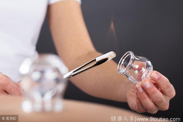 血压高不用烦恼了，3大拔罐法，“拔”走高血压！