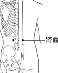 血压高不用烦恼了，3大拔罐法，“拔”走高血压！