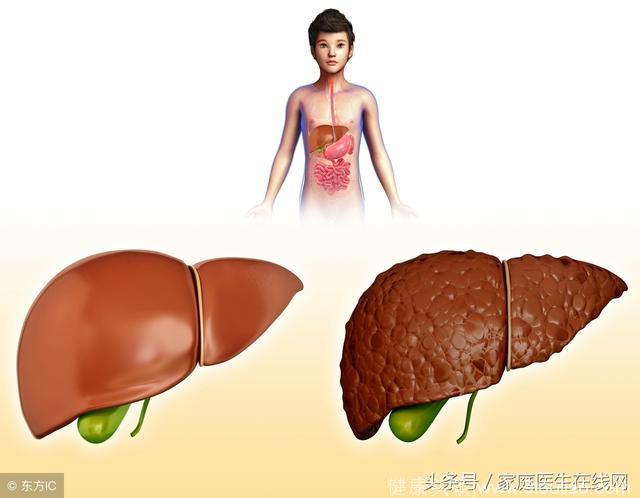 肝区隐痛可能是患上了肝病？这6种肝病，都会导致肝区疼痛