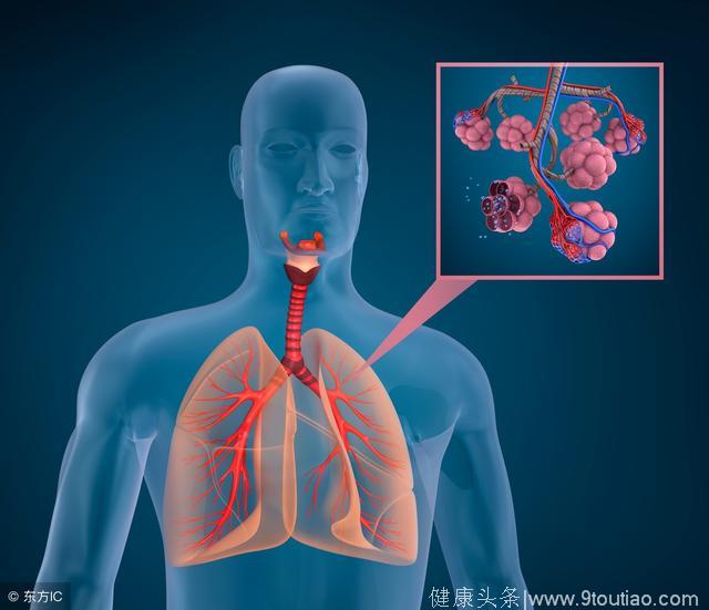 肺癌的早期五个典型症状是怎么样的呢