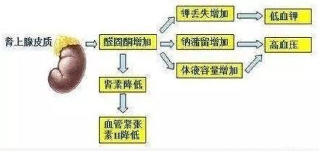 大爷长期高血压血钾却很低，手术后高血压被治愈？