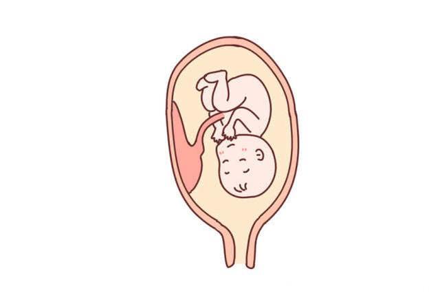 孕早期做阴道超声，超声波会损害腹中宝宝吗？