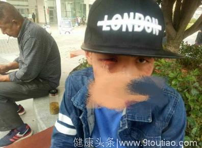 芜湖：少年遭多人无故殴打后患抑郁 父母悲愤讨说法