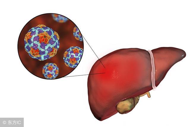 掌握了这3个方法，乙肝患者将远离肝硬化、肝癌！
