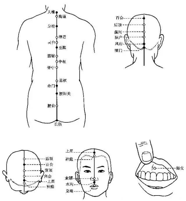 针灸找不准穴位怎么办？取穴心法显神通！