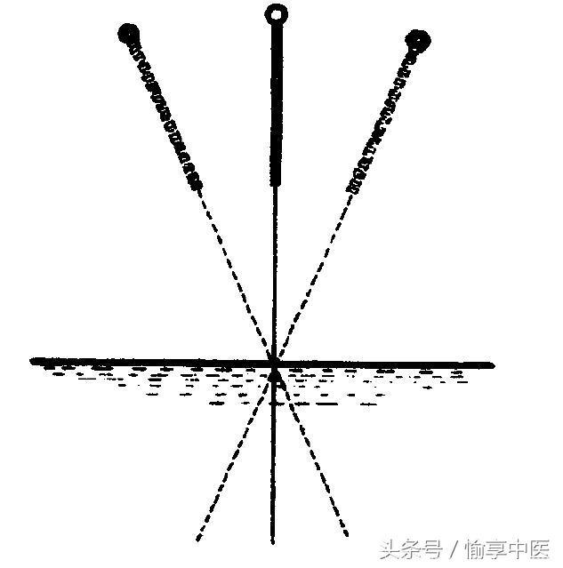 郑魁山谈针灸基本功（四）：行针候气法