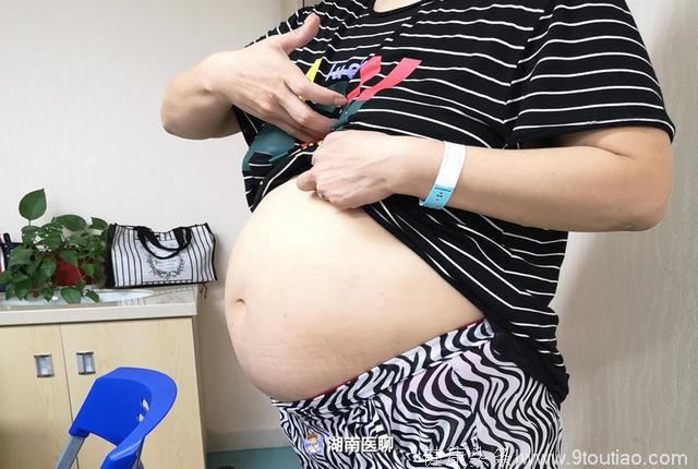 湖南大妈挺“大孕肚”，手术取出10斤瘤子，子宫都“变了形”