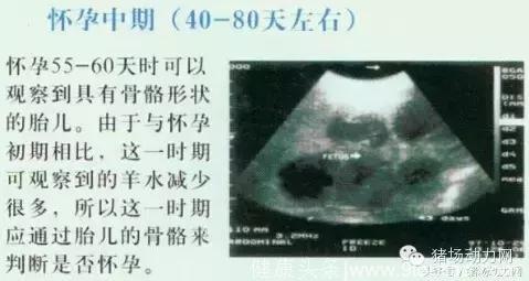 怀孕母猪20天到90天的B超图像，你会看吗？
