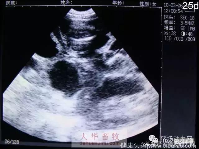 怀孕母猪20天到90天的B超图像，你会看吗？