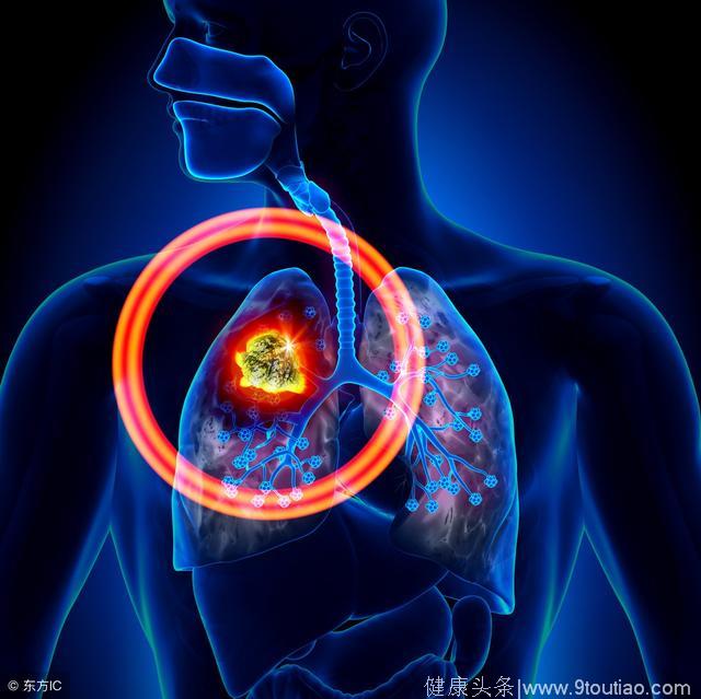 专家告诉你8个癌症信号，大家可要警惕了