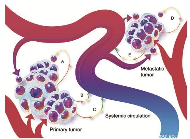 《科学》子刊：癌细胞“大义灭亲”！哈佛科学家将癌细胞改造成冷血抗癌杀手，杀遍全身肿瘤后自杀｜奇点猛科技