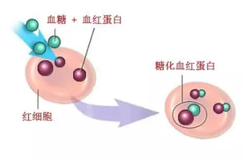 1型糖尿病居然可以治愈？美国麻省总医院发现卡介苗治愈1型糖尿病