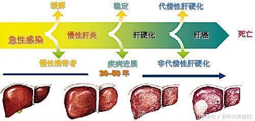 专家提醒，4种疾病容易发展为癌症，快来看看你有没有中招？