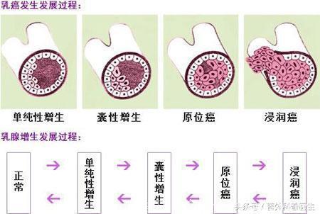 专家提醒，4种疾病容易发展为癌症，快来看看你有没有中招？