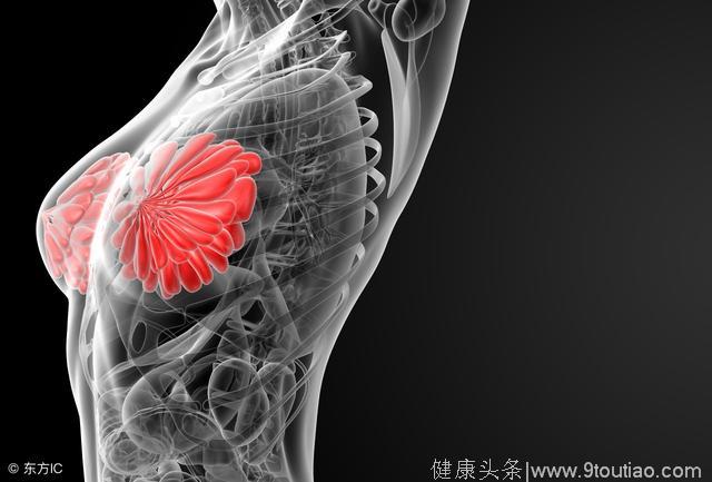 乳腺结节是乳腺癌的主要表现形式？需警惕恶化，别轻视了