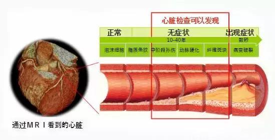 为什么日本体检可以查出早早期癌症？