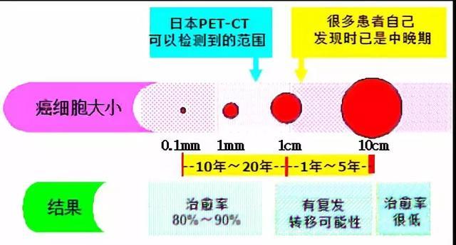 为什么日本体检可以查出早早期癌症？