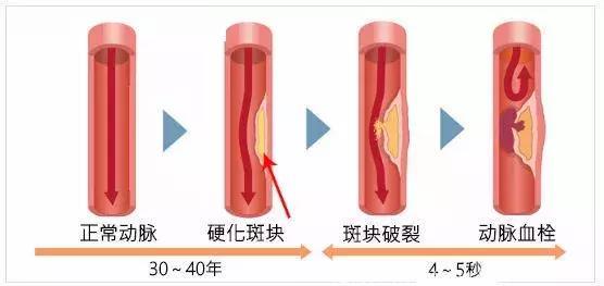 为什么日本体检可以查出早早期癌症？