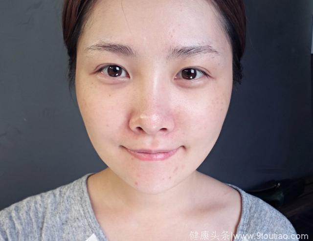 女人过了40岁脸上有斑？不妨“按一按”这两个穴位，淡斑显年轻！