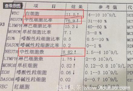 如何区分病毒性感冒和细菌性感冒