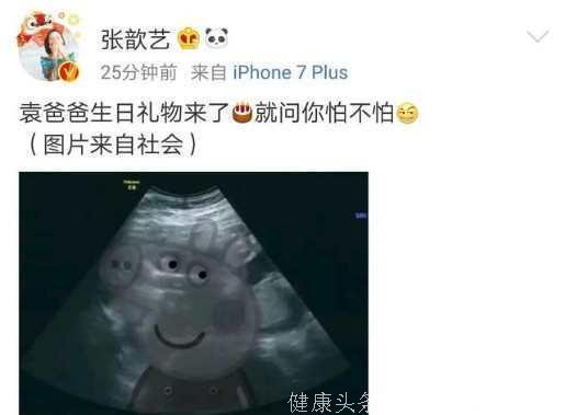 张歆艺终于怀孕，晒出的B超照片中，露出这一细节
