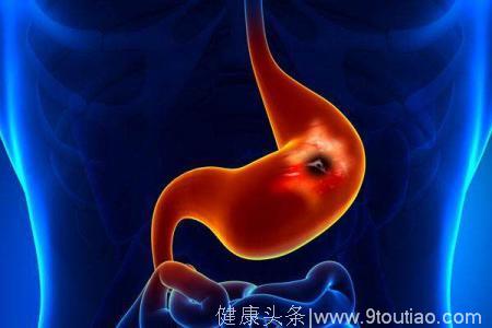 每年20万中国人死与胃癌，得胃癌的人，通常喜欢吃这3类食物