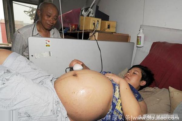 34岁高龄产妇生下双胞胎，还没来得及松口气，医生又把手伸进去