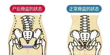 医生说：哺乳期肚子依旧大，不要怕坚持做到这八件事不辈子不遭罪