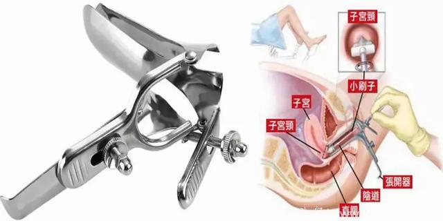 全程真实体验详解：在新加坡做子宫颈癌抹片免费检测