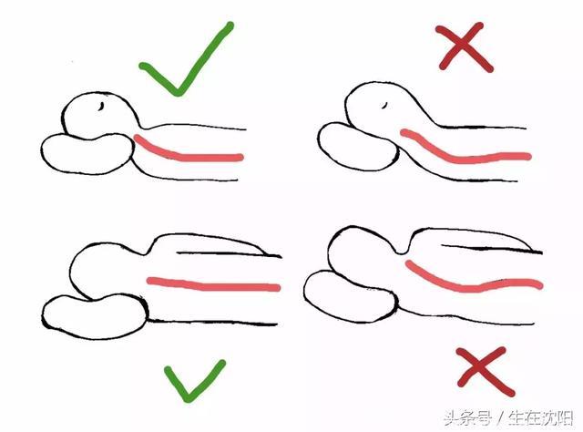 有的人活着，但他的颈椎已经快死了…… 华西医院