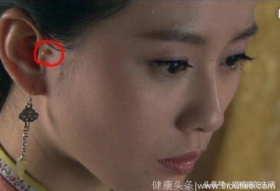 明星的缺陷：刘诗诗的耳朵，吴京的手，而她却生下来就没有子宫