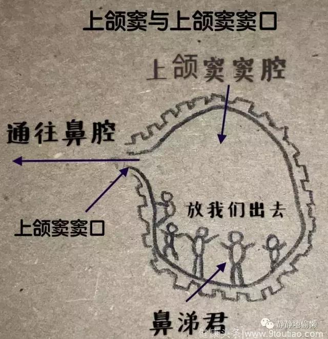 “鼻炎”“鼻窦炎”傻傻分不清楚？！