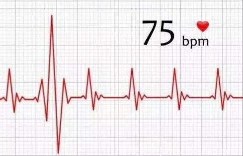 高血压患者为什么降血压同时还要降心率？
