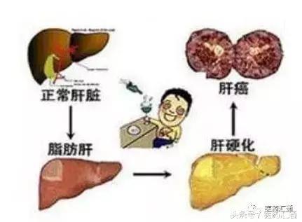 师胜杰、臧天朔等因此而逝世，这种癌不痛不痒，一旦发作就是晚期