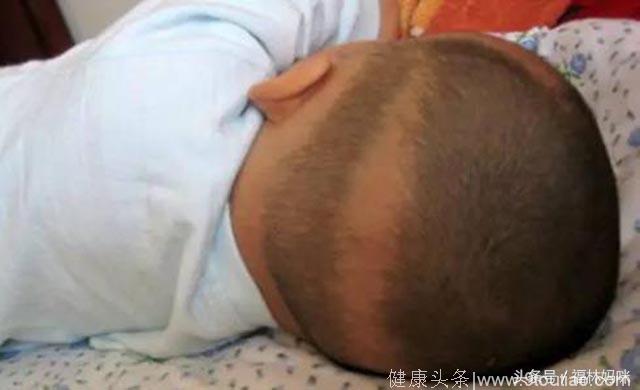 宝宝后脑勺出现“枕秃”？可能因为身体缺乏这三种元素！