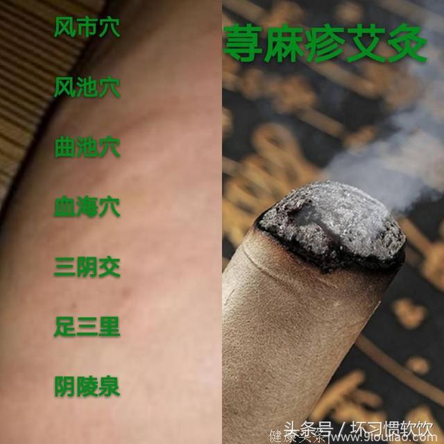 荨麻疹刮痧内清外透，荨麻疹艾灸祛风止痒，如何有效操作？